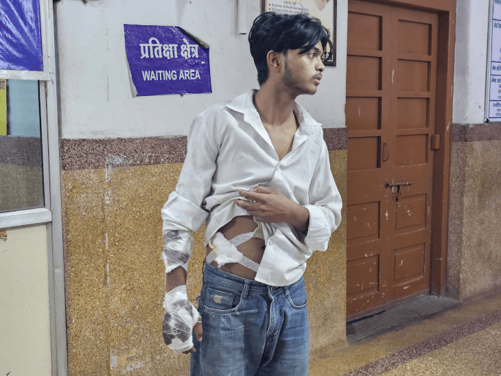बाइक की राहगीर से टक्कर, चाचा-भतीजा समेत तीन घायल:मंदसौर में दोनों गरबे की ड्रेस लेकर लौट रहे थे, एक गंभीर  उदयपुर रेफर