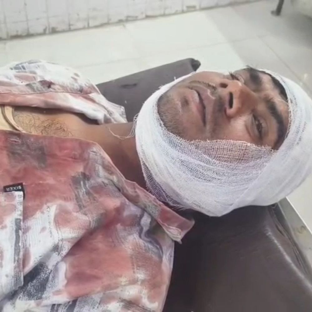 एक फीट जमीन के लिए छोटे भाई को पीटा:बंदूक की बट से सिर पर किया वार, पति-पत्नी अस्पताल में भर्ती