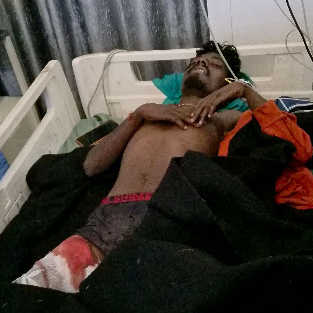 हजारीबाग में फायरिंग, दो युवक घायल:केरेडारी में बाइक लूटने की कोशिश का आरोप, दो युवकों ने वारदात को दिया अंजाम