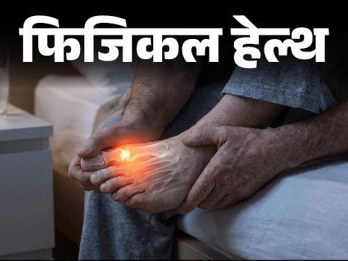 फिजिकल हेल्थ- दुनिया भर में बढ़ रहे ‘गाउट’ के केस:पुरुषों को रिस्क ज्यादा, डॉक्टर से जानें इस बीमारी को कैसे पहचानें, कैसे बचें