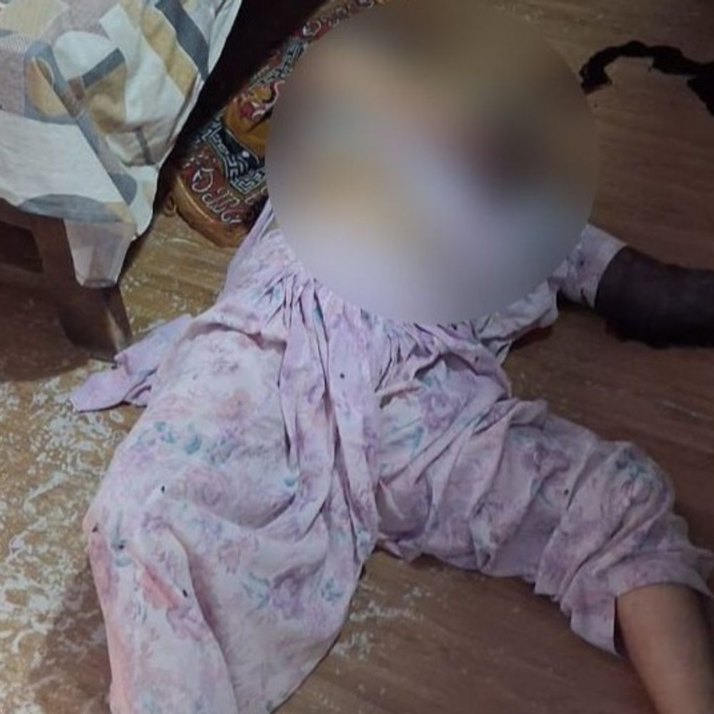 हिसार में महिला बुजुर्ग के हत्यारोपी का एनकाउंटर:मॉडल टाउन में अकेली रह रही थी महिला; सीसीटीवी में कैद हो गया था आरोपी